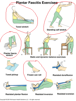 plantar fasciitis 3.jpg